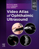 Video Atlas of Ophthalmic Ultrasound 1st Edition