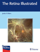 The Retina Illustrated