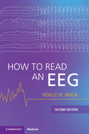 How to Read an EEG 2nd Edition
